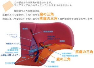 プログリップメッシュ